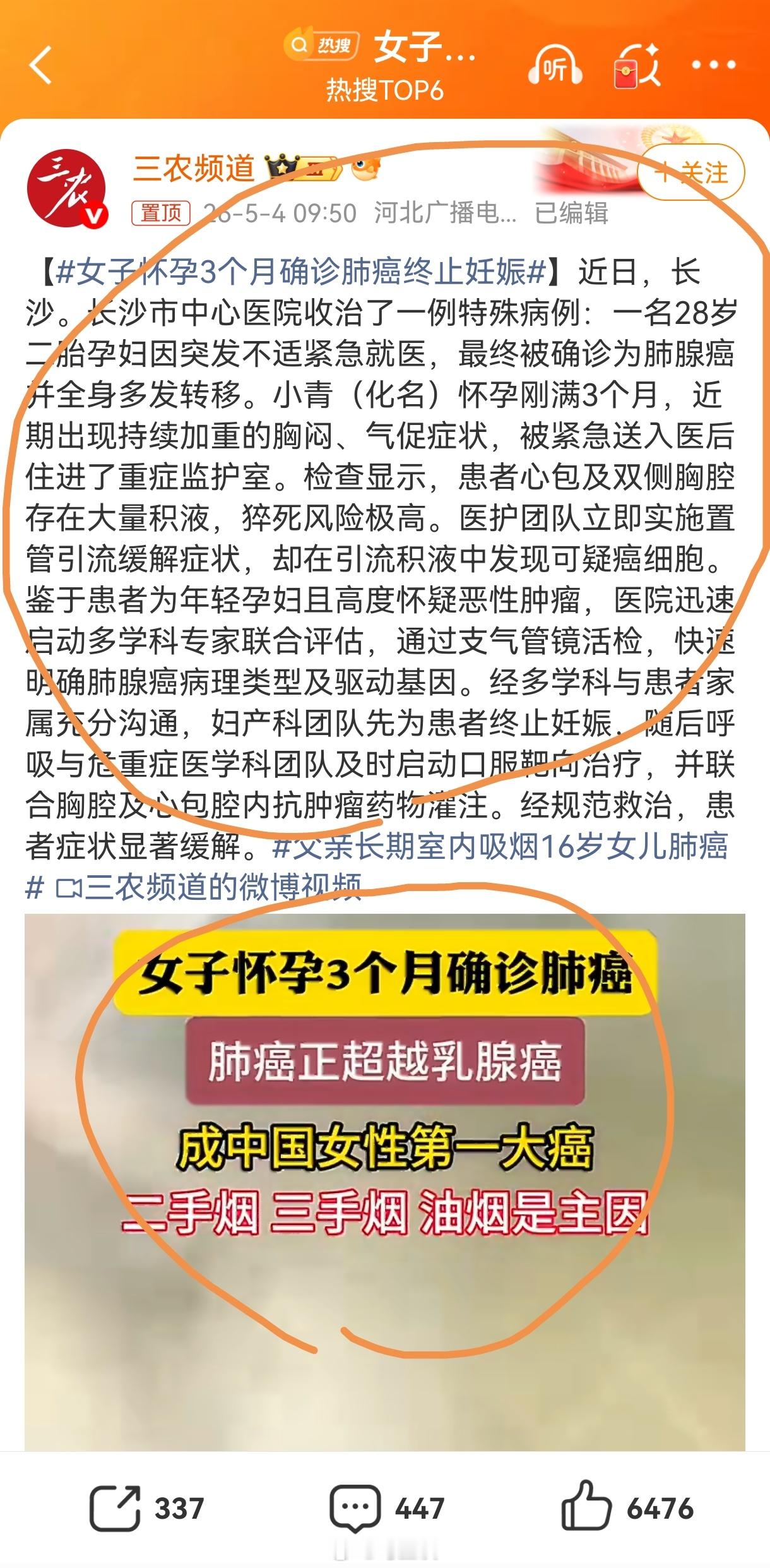 女子怀孕3个月确诊肺癌终止妊娠新闻文字里没有提到丈夫吸烟，但是视频里却拐到二手