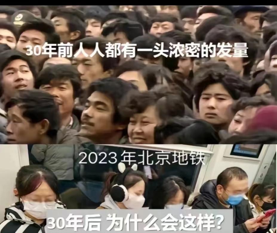 人到四十多岁，头发变细、变少，是多种因素共同作用的结果，其中最主要的原因是雄激素