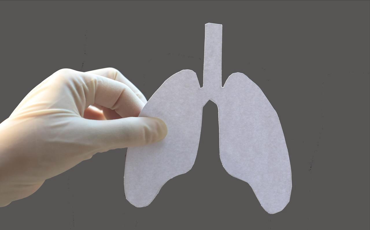 肺结节出现这种变化一定要当心，有恶性的风险，起码要短期内复查肺结节患者最怕是什