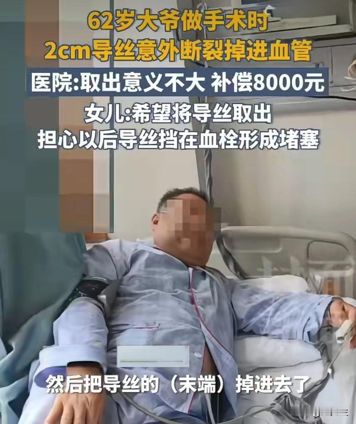导丝断留血管！一根细小的手术导丝，本应是救命的工具，却意外断裂，残留在了62岁
