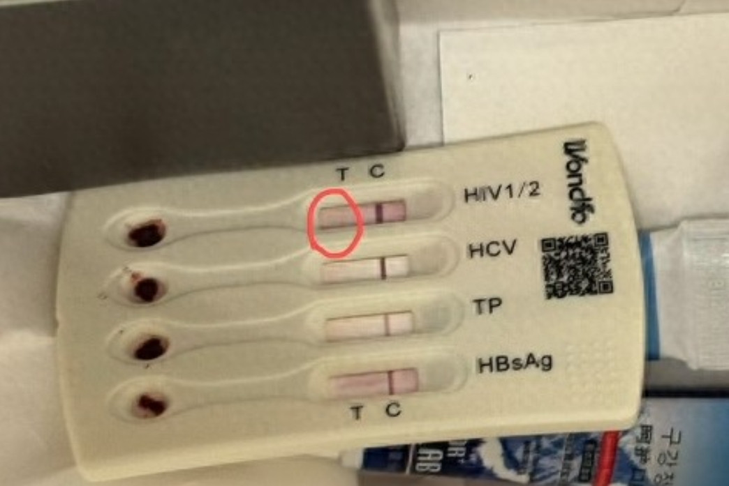 男子入住酒店发现用过的HIV检测盒，紧急就医后要求酒店负责
