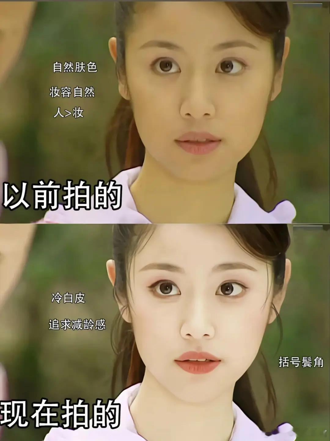 现在都不允许女明星脸上有瑕疵，有黑眼圈了