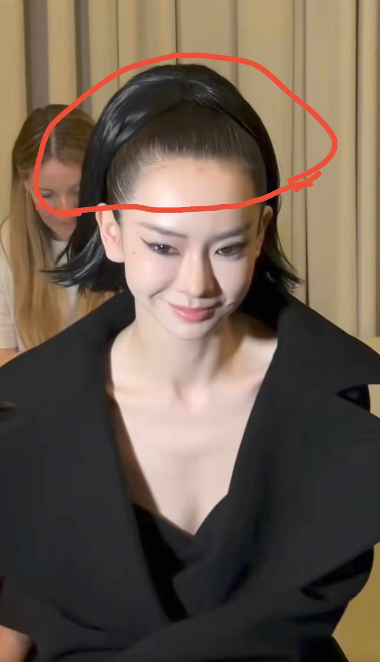 戚薇这是又去做拉皮项目啦！瞧这操作，不仅面部的皮肤被提拉得紧紧的，连头皮都像是跟