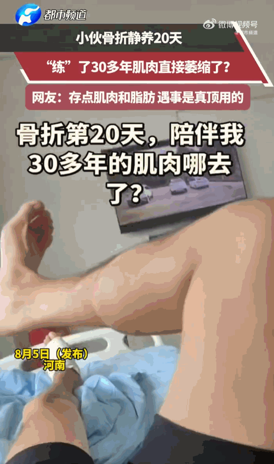 万万想不到，卧床养伤20天，竟能毁掉30年的肌肉老本？河南一位骨折小伙的遭遇，这