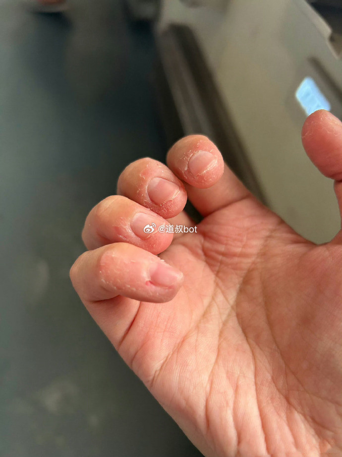 网友发帖，自己乘坐兰州铁路局K228次火车卧铺时因月经突然来临，车上买不到卫生巾