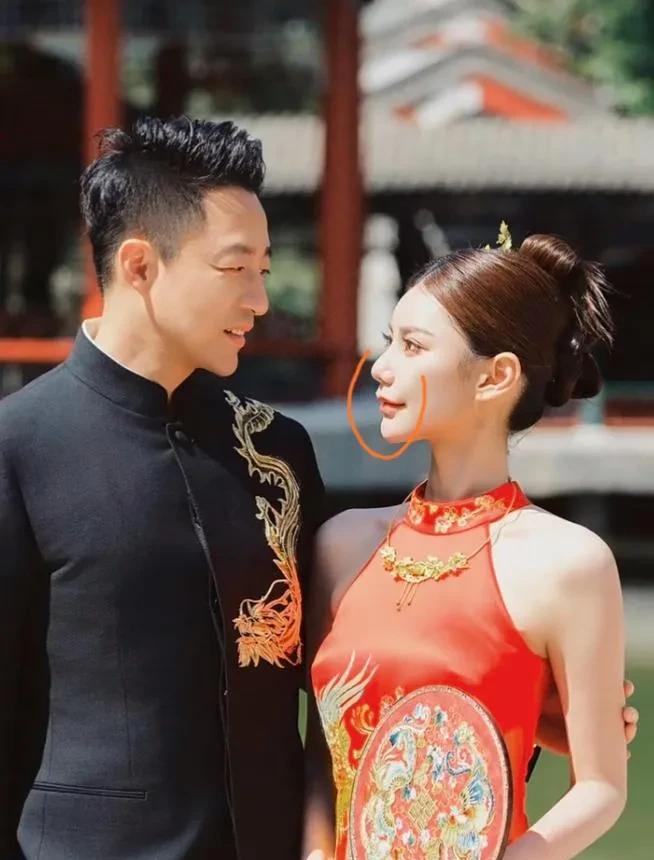 汪小菲马筱梅婚礼对视瞬间被定格。仔细看马筱梅，说实话，发现她也不是多漂亮，脸上