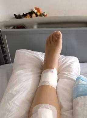 湖南祁阳，一男子做骨科手术，手术的右腿却一直疼，他跑了5个月的医院，才惊讶的得知