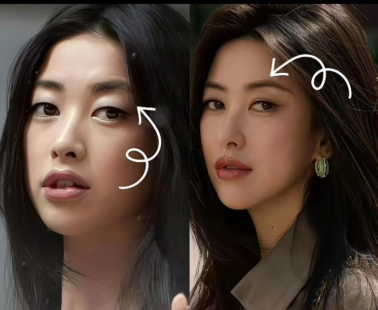 原来她也是整容过的呀？