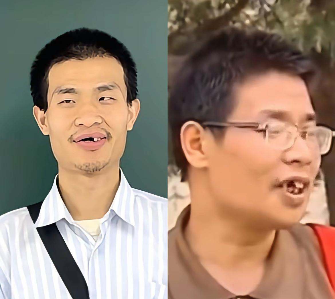 感觉韦东奕的牙齿有可能是遗传原因，因为看起来和他爸爸的牙齿是一样的。不过刷到韦