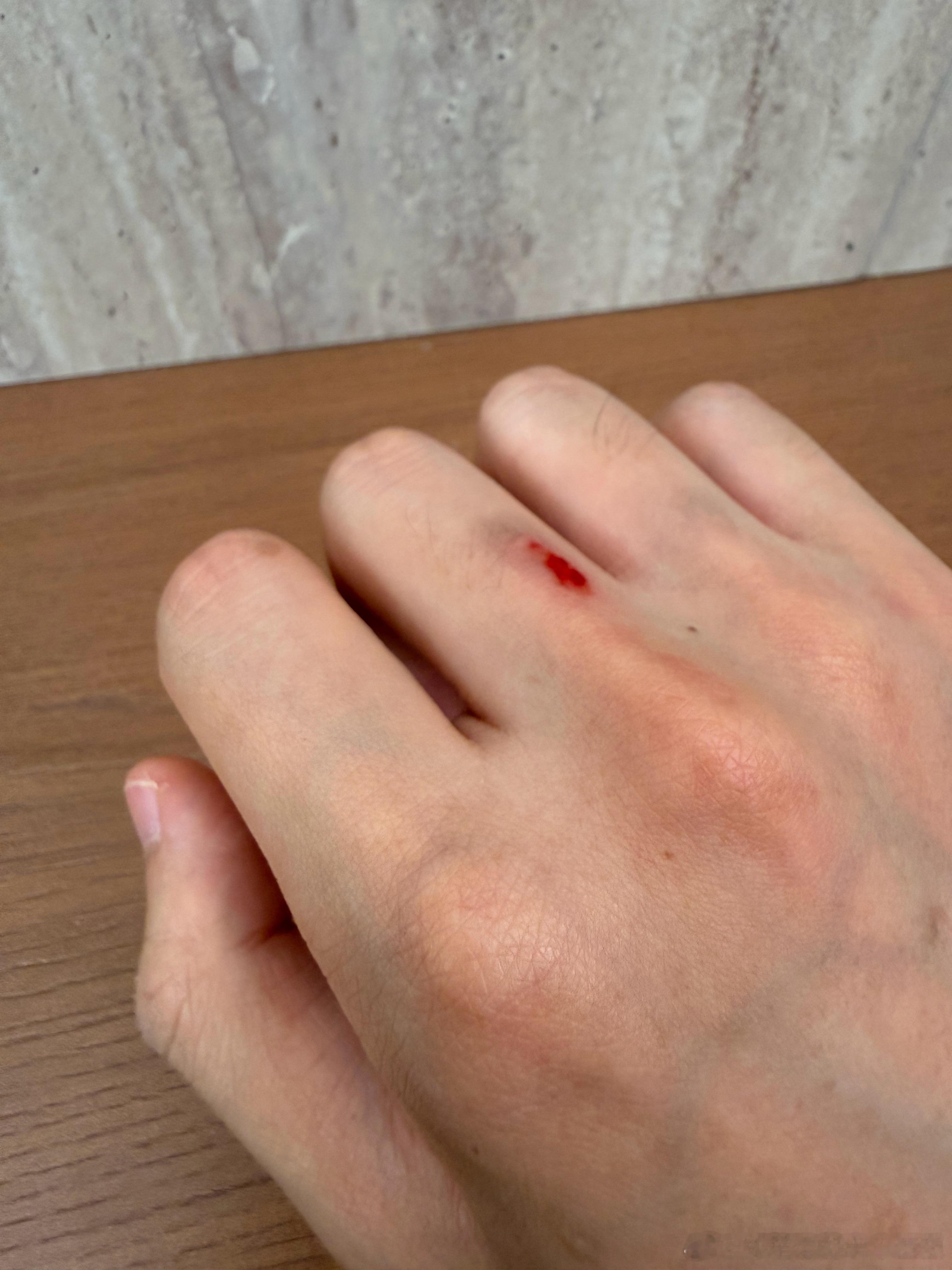 不清楚手上何时多的一颗红宝石…