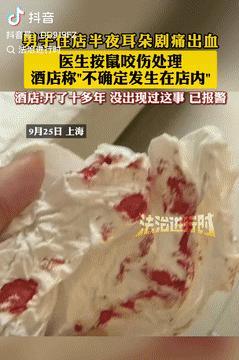 真够倒霉的！上海，一男子在酒店睡觉时，突然听见咯吱一声，接着被一阵剧痛给惊醒，醒
