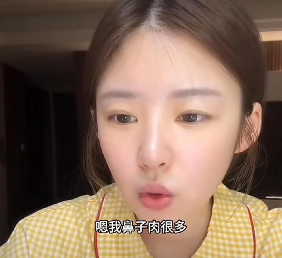 黄一鸣：“我以前鼻子肉很多，我觉得不好看就去整容了，结果整容了2次都失败了，它慢