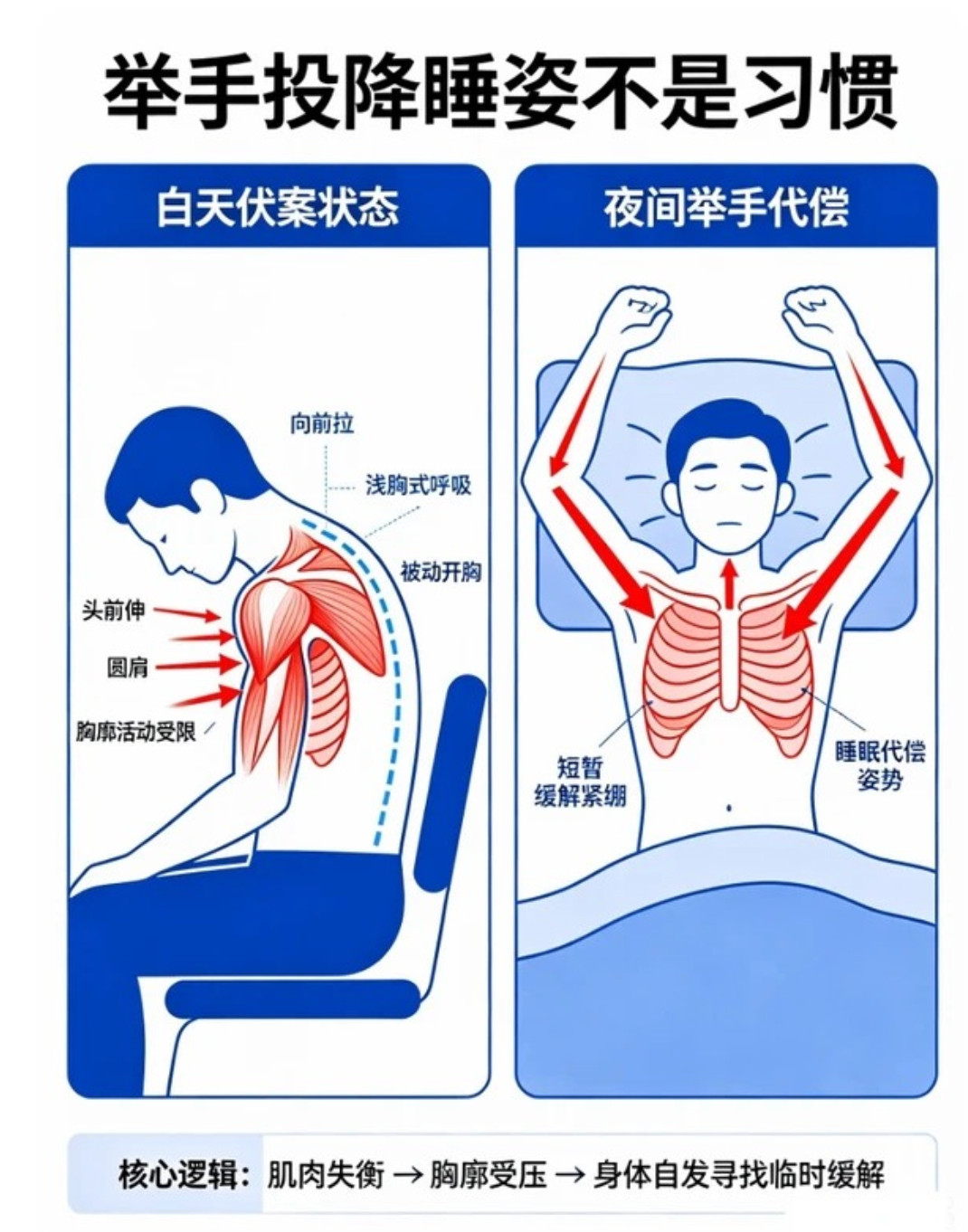 举手式睡姿是身体在求救投降睡觉舒服，是劳累的代偿。-白天工作：含胸、圆肩、头