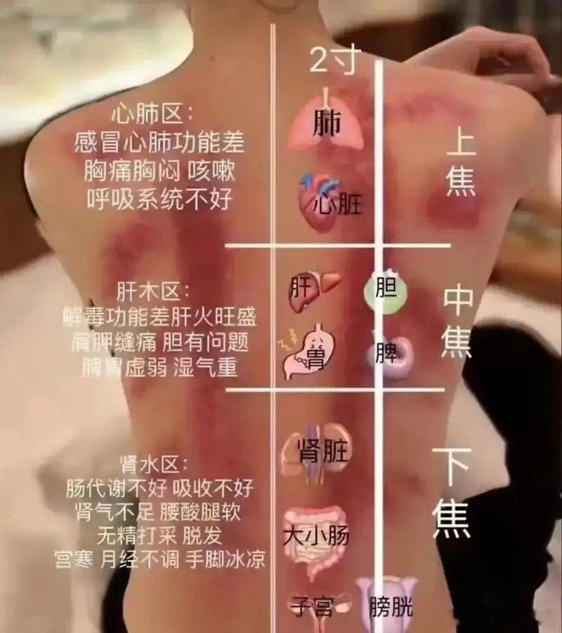 失眠是“阳气回不了家”！睡前一个动作，把飘在外面的阳气收回来原创半夏微凉的记忆