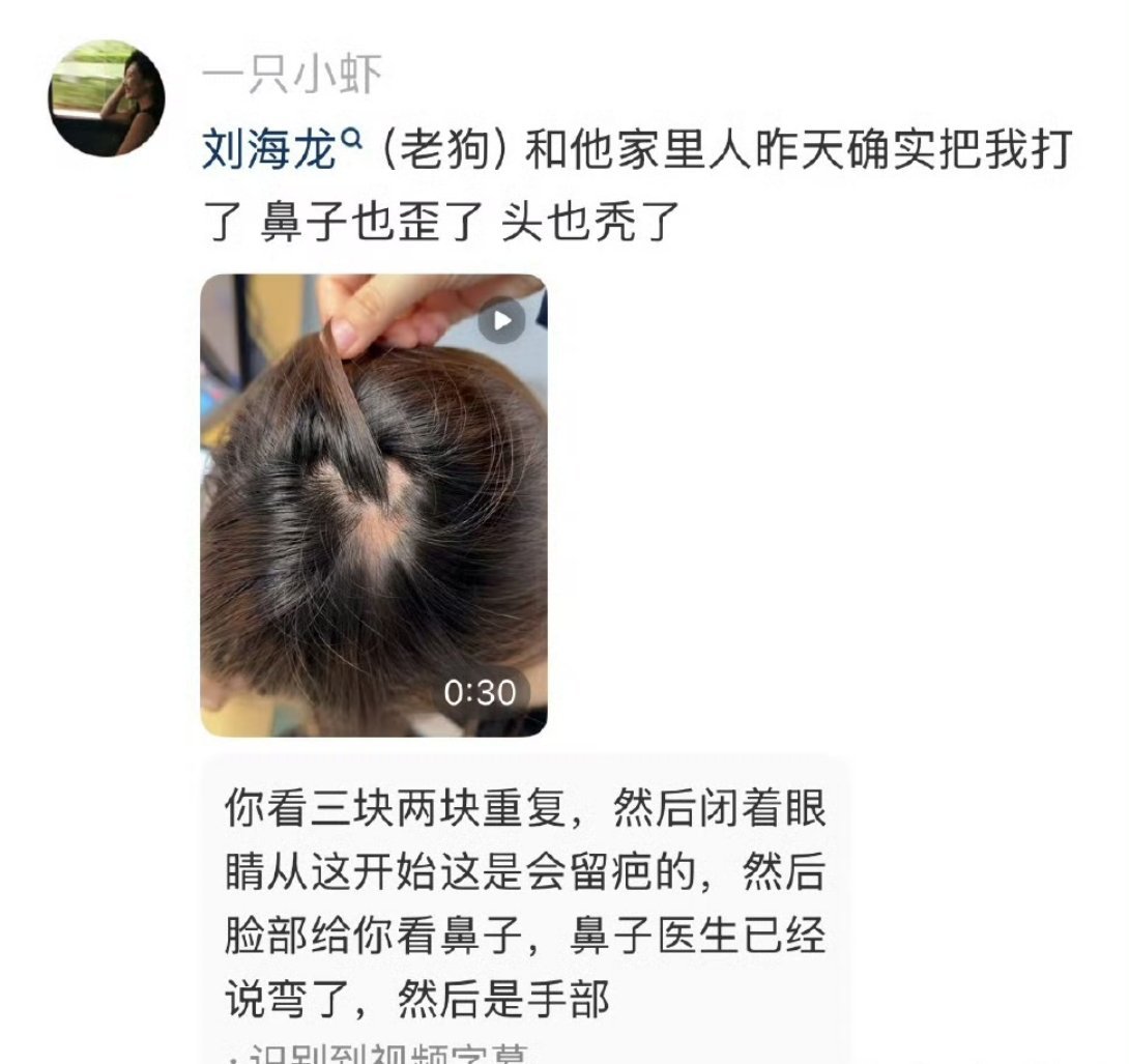 韩安冉助理被打我的天。。。这到底咋回事这个助理真的好惨啊