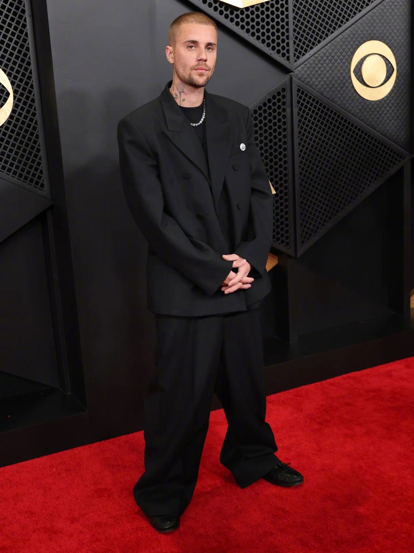 外网热议：贾斯汀.比伯植发了！！！