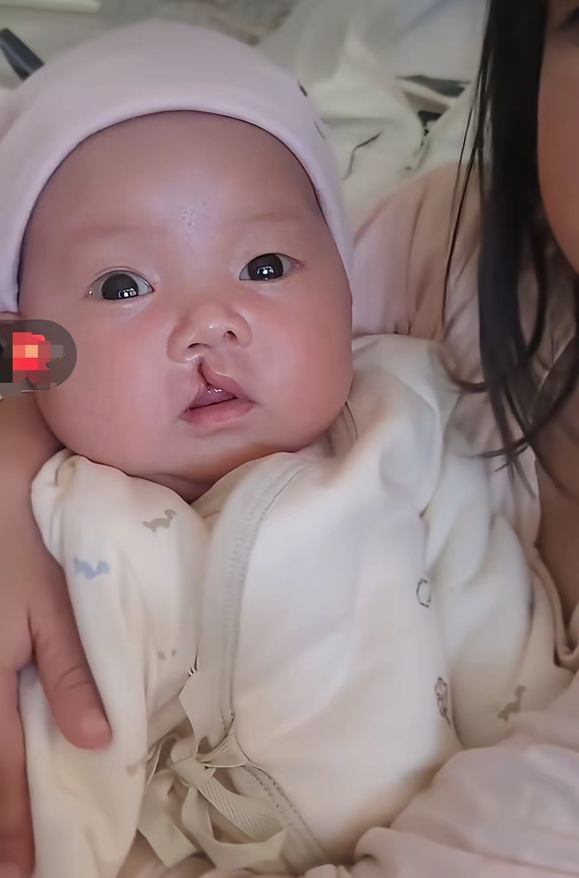 被李亚鹏无偿救助的小女孩