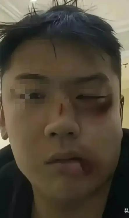 男子不孝顺母亲，春节假期被舅舅训了一顿。他心里不服气，故意在还没有出正月的时候就