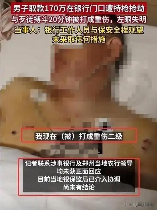 男子取170万被抢致失明！银行职员冷眼旁观真寒心！2024年7月，郑州倪先