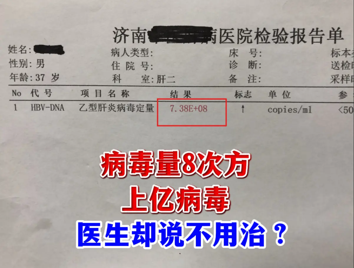 一位德州的小伙子咨询，今年26岁，体检查出乙肝，病毒量高达8次方，上亿...