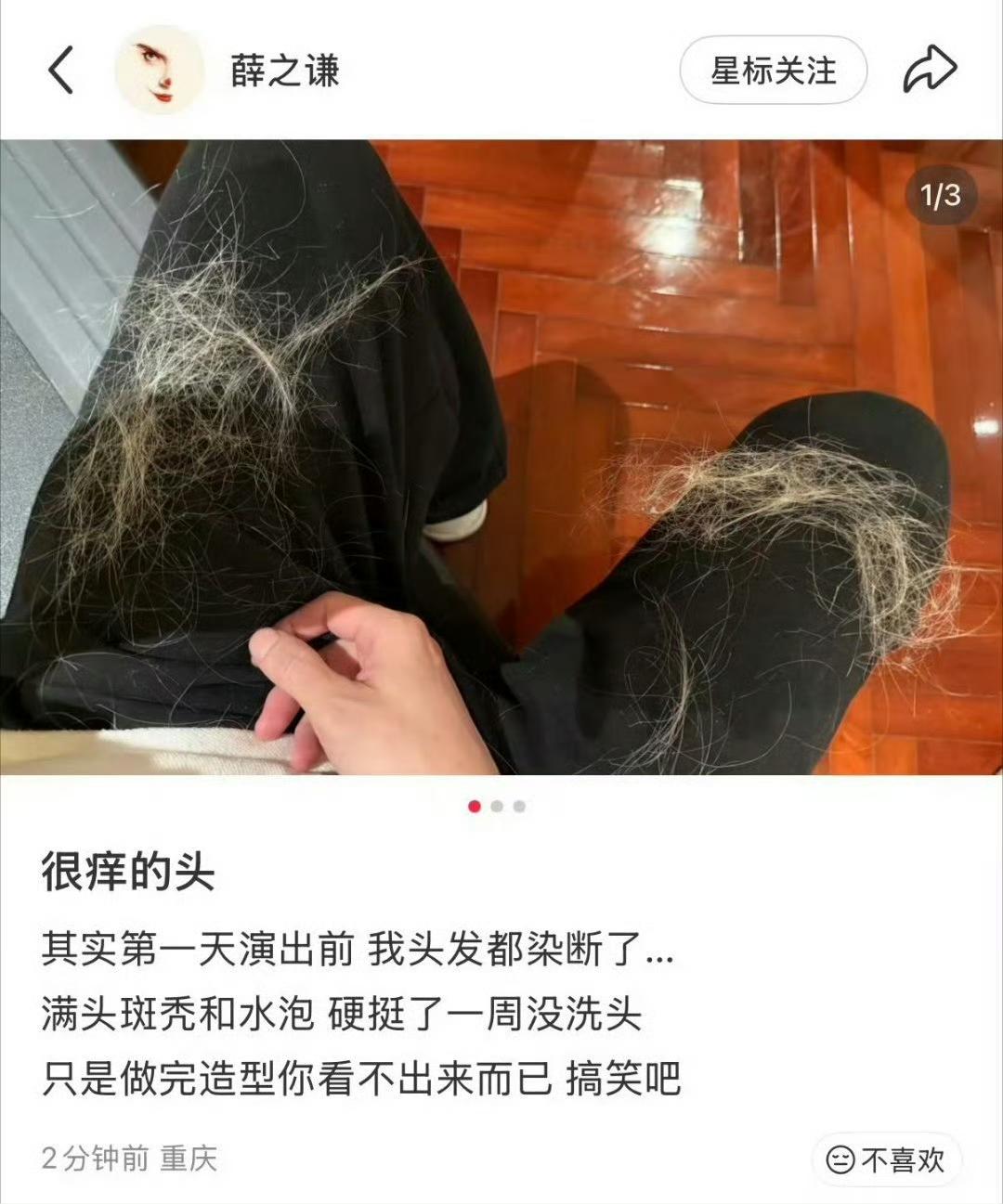 薛之谦满头斑秃和水泡谁看了不心疼！为了万兽之王舞台完美，老薛一遍遍漂染，头