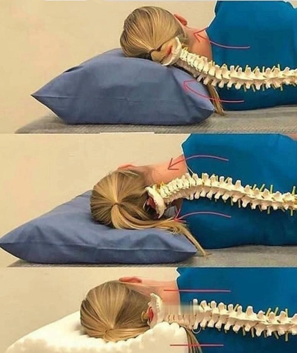 人的脊柱有四个生理曲度，而枕头，就是帮助我们在睡觉的时候维持好颈椎的生理曲度。所