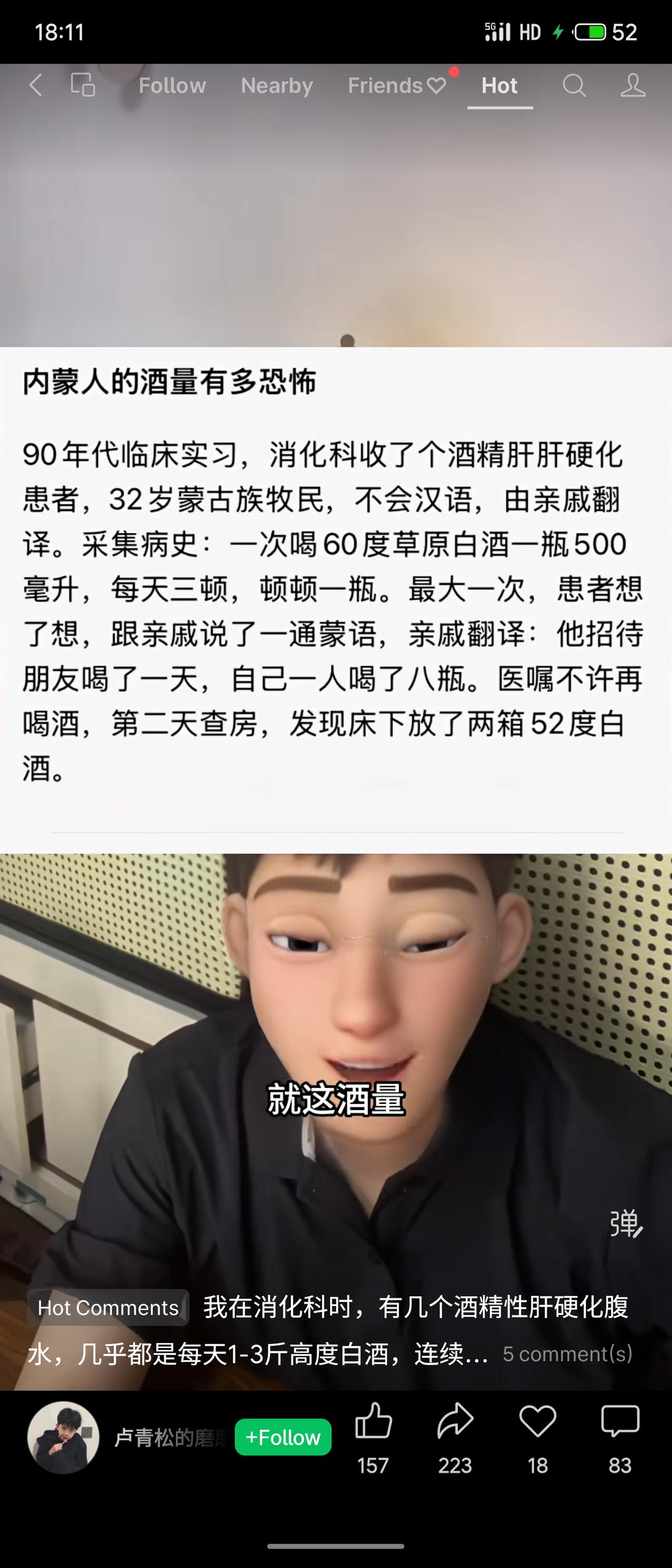 90年代实习，32岁蒙古族牧民酒精肝住院，平时每天三顿各一斤60度白酒，最多一次