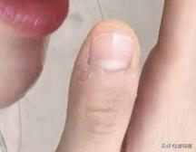 难以置信这是来自女明星的手指甲，王楚然也太没偶像包袱了吧，这波是真接地气。都说