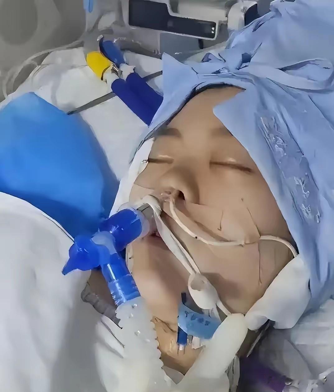 2022年，高三女生在高考前，在家吞药而亡，父母忍痛把她的器官全部捐出来，就在父