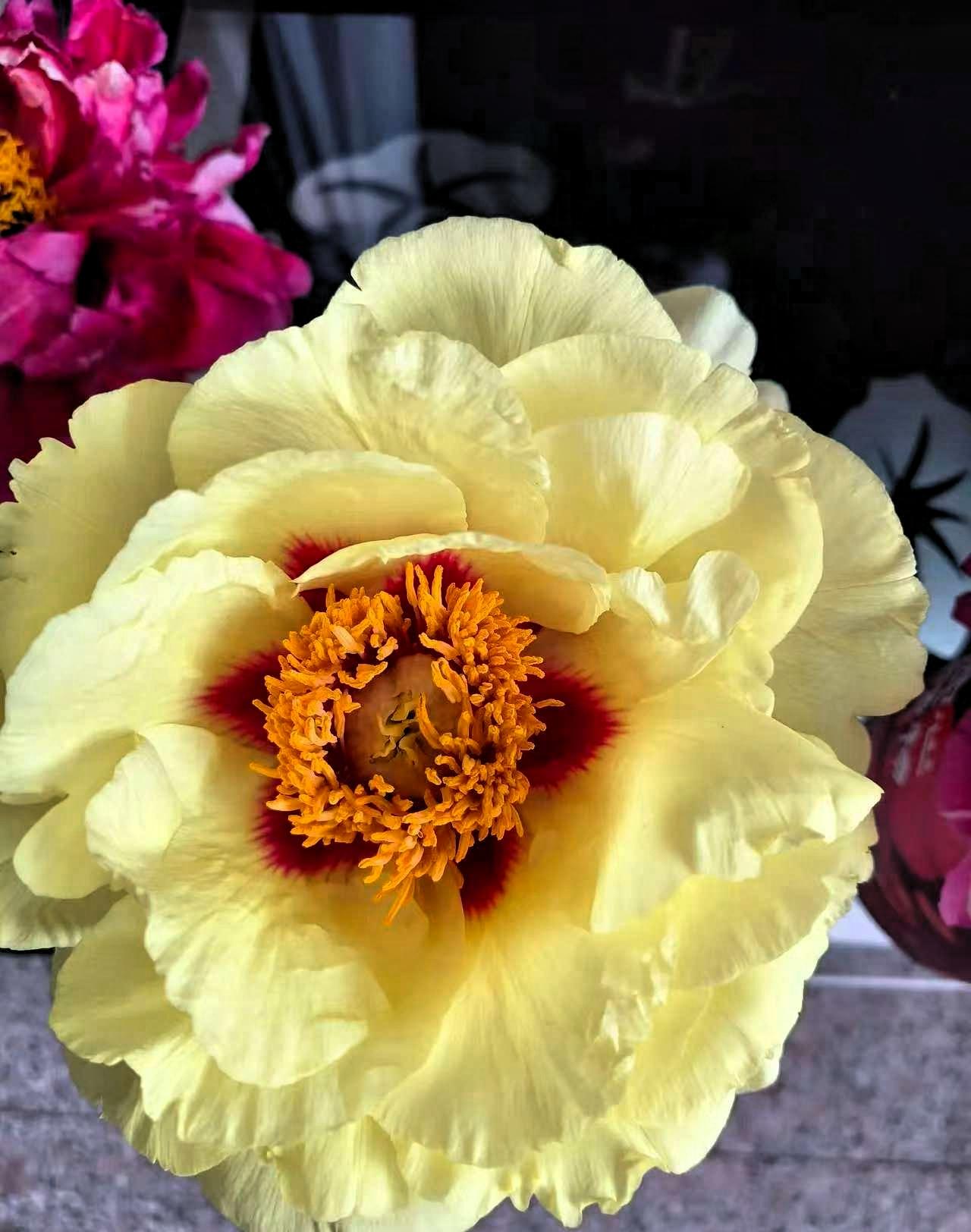 别染发，别染发，别染发4月15日，主持人尼格买提晒出眼部严重肿胀的照片，简