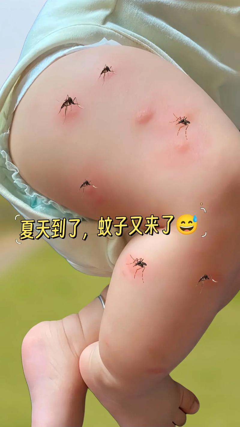 蚊子有多聪明，你知道吗？受害最深的是孩子，这小东西，可精着呢！