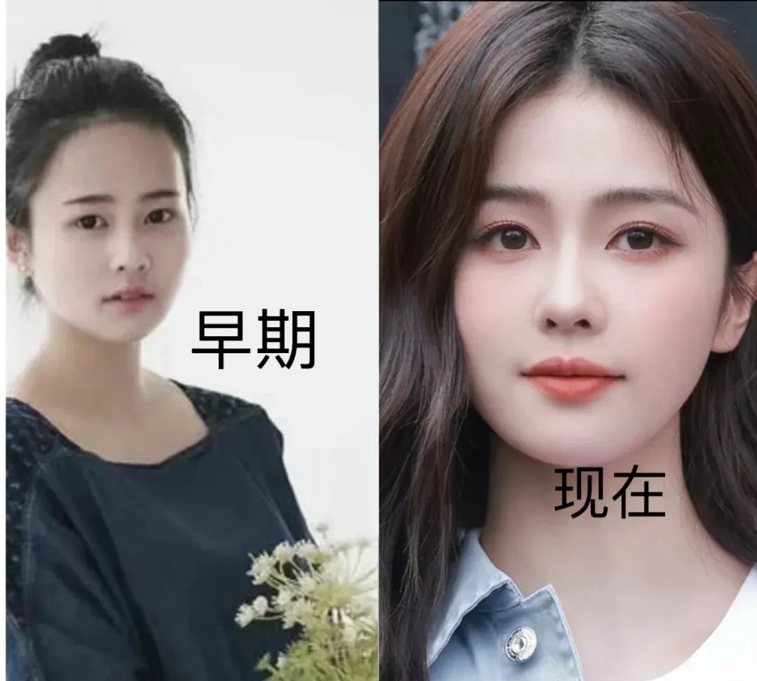 我爸妈看了白鹿的照片沉默了好一会儿才说话她们突然说，白鹿整容前