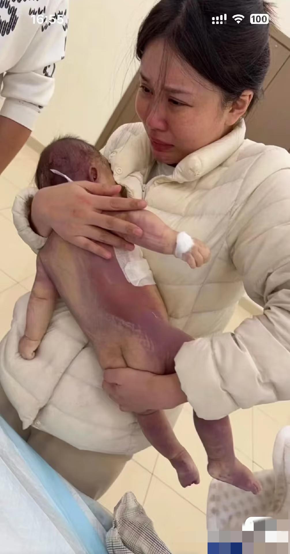 我问Deepseek，像小洛熙这样5个月大的婴儿需要做卵圆孔未闭合手术？D