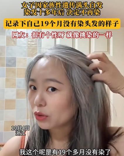 2025年7月浙江，一女子发现几根白发，她本以为拔了就是！万万没想到，仅仅几个月