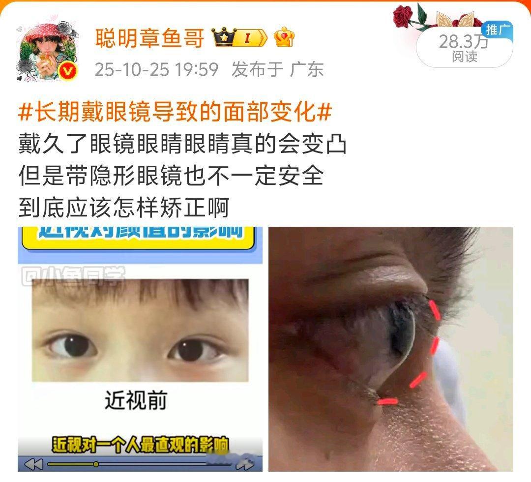 我兴奋过头才看见，丈育一个眼睛眼睛是什么鬼[？？？]​​​