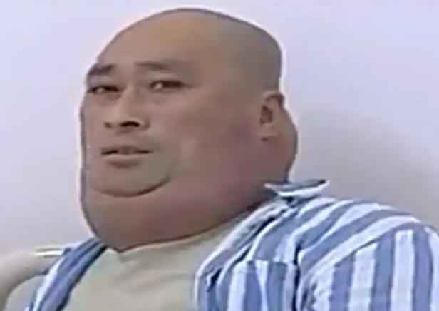 这可真够吓人的，连大夫瞧了都直叹气。2013年年底，东北的李秋武把自己捂得密不透