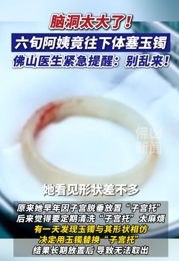 脑洞大开！广东佛山，一名65岁阿姨因为“阴道异物”去医院检查，结果医生检查时发现