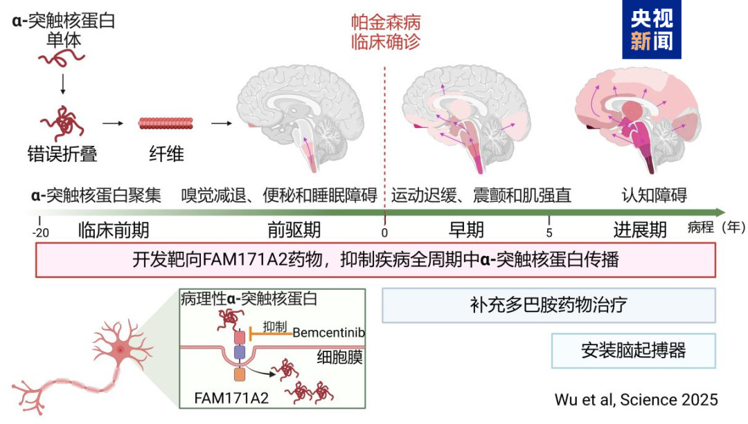 【我国科学家发现帕金森病治疗新靶点】科技新突破2月21日据新华社报道，国