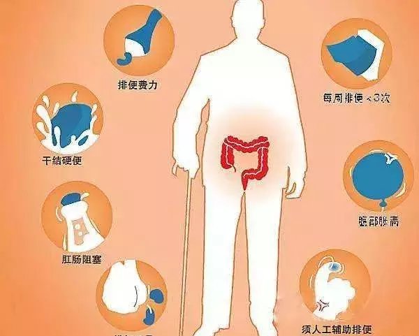 吕梁肛泰: 【疾病与预防】五个老年人就有一个中招! 老人便秘怎么办?