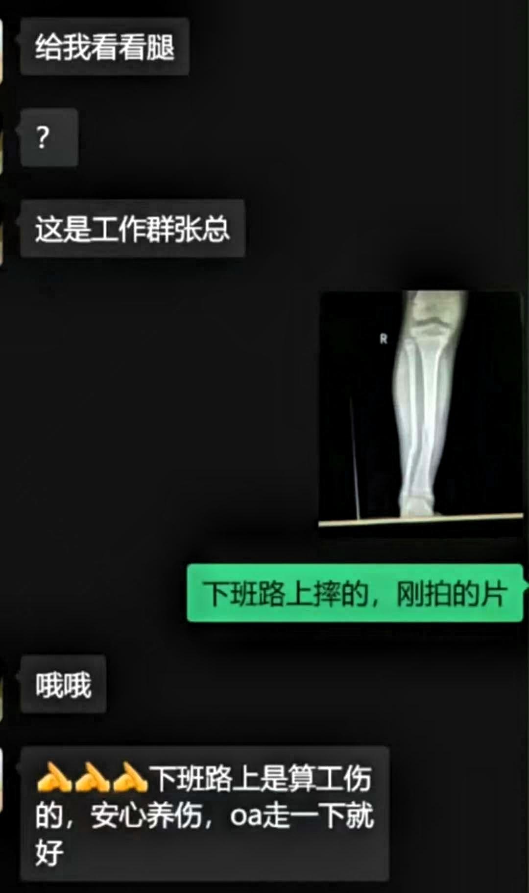 顶级救场，领导调惜女员工，发错群里场面一时变得尴尬。领导不便过多解释，员工也不