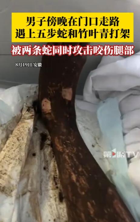 电视剧都不敢这么演！安徽，一男子傍晚散步时，偶遇竹叶青和五步蛇打架，不料