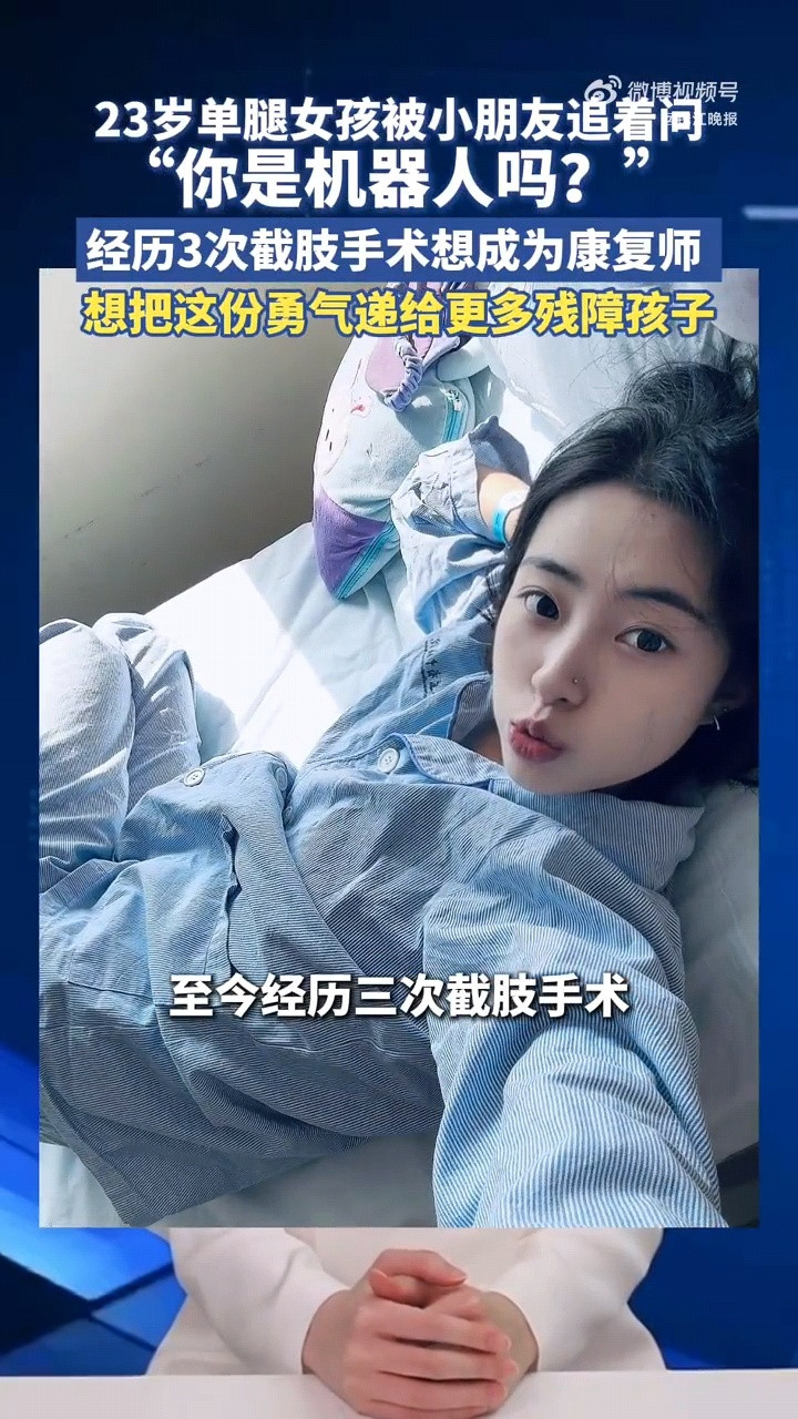 大家好像总觉得戴假肢的人应该很惨，但苗苗直接把这印象给掀了。她不避讳露假肢，还活