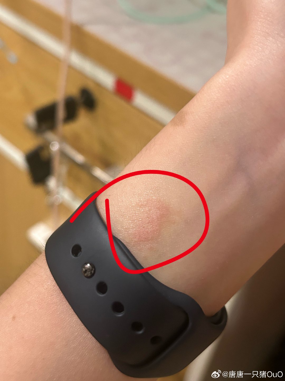#宝贝小公主#猪宝们，你们戴这个AppleWatch的原装表带会这样嘛？也不疼就红红的一块，有时候有