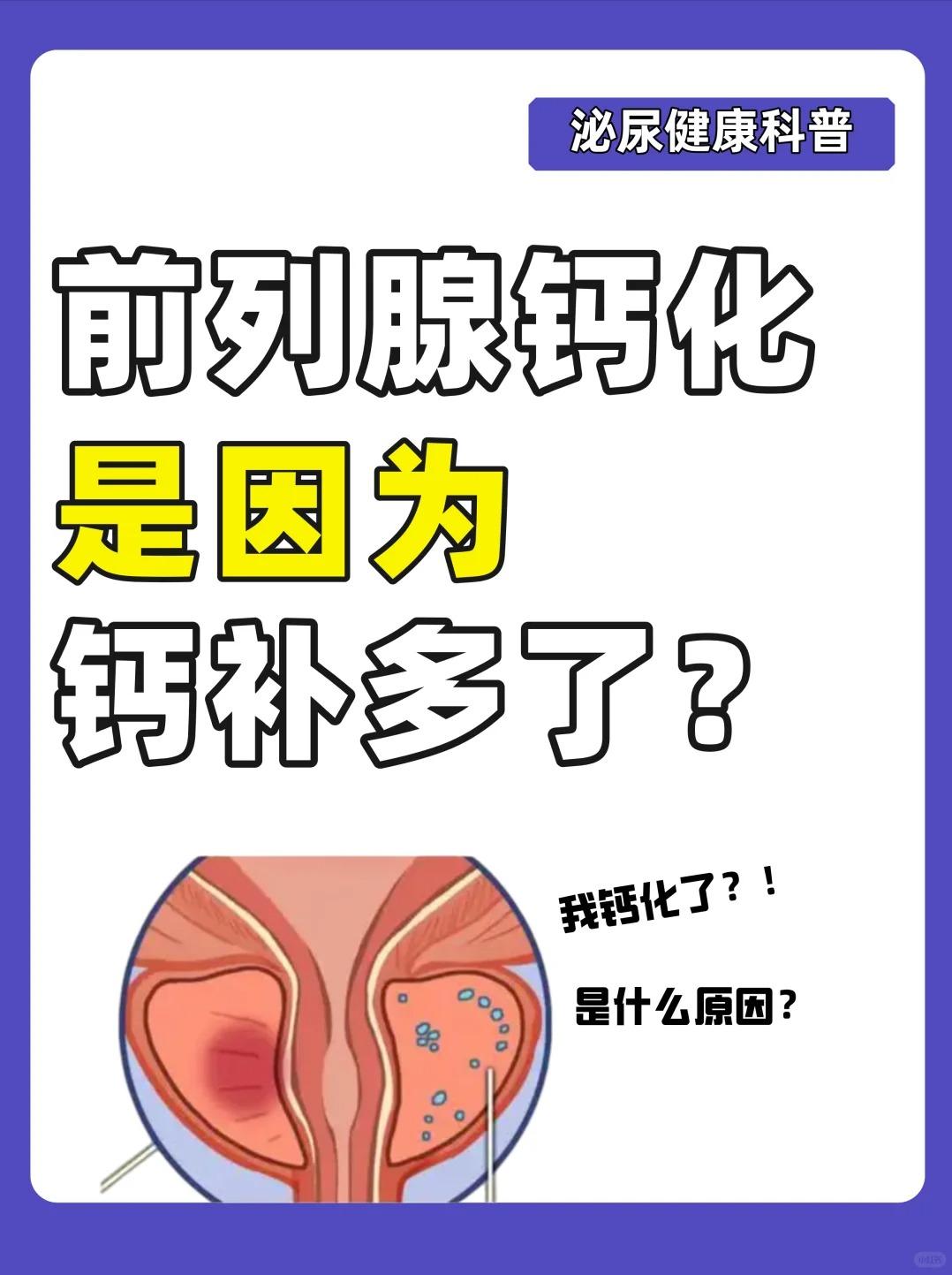 前列腺钙化是因为钙补多了吗？