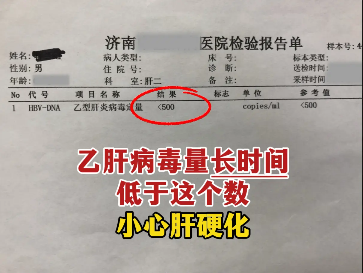 前阵子接诊一位山东本地的患者，查出乙肝就开始吃抗病毒药，中间查过一次...