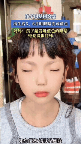 基因突变，女孩天生蓝瞳小姑娘刚出生时眼眸和普通人并无区别，长到五六个月，双