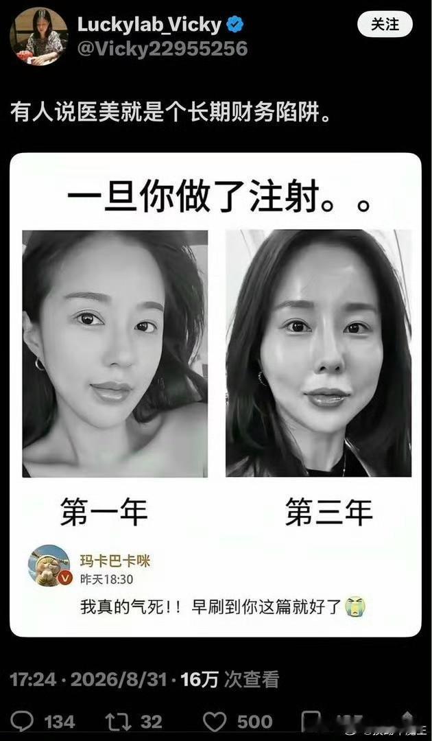 医美行业故意设置的保持1年吧，打几针说要1万多，然后每年都得打，真的是坑。高