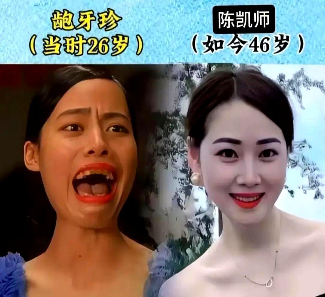 刷到龅牙珍近照那会儿，我手里的泡面差点没端住。当年那个追着包租婆满街跑的疯婆子
