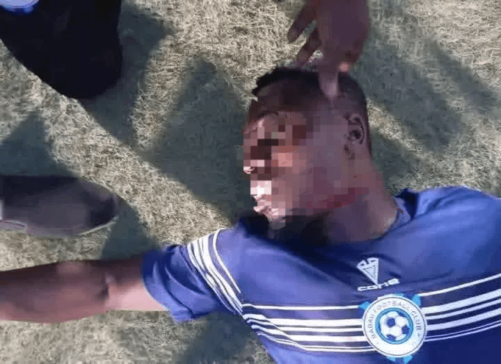 恐怖! 尼日利亚联赛一球员在比赛中遭遇对手球迷割喉