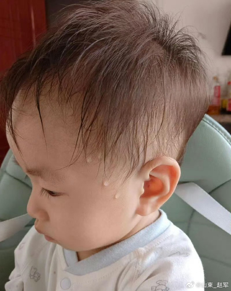 诸病察源细说“汗”系列一自汗中医认为汗为心之液，由津血转化而来，是人体体液重要组